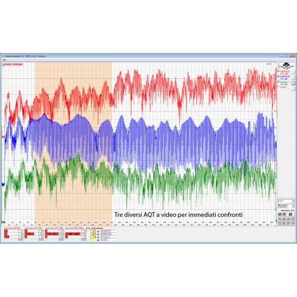 Progetti di trattamenti acustici